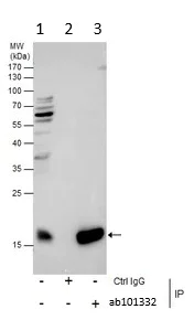 Immunoprecipitation - Anti-Centrin 1 antibody (AB101332)
