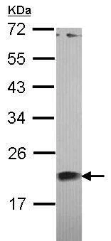 Western blot - Anti-Centrin 1 antibody (AB101332)
