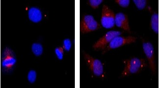 Immunocytochemistry/ Immunofluorescence - Anti-Centrin 1 antibody (AB156858), expandable thumbnail