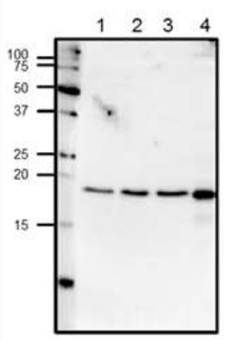 Western blot - Anti-Centrin 1 antibody (AB156858), expandable thumbnail