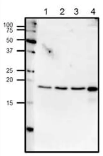 Western blot - Anti-Centrin 1 antibody (AB156858)