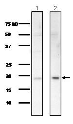 Western blot - Anti-Centrin 1 antibody (AB156858), expandable thumbnail