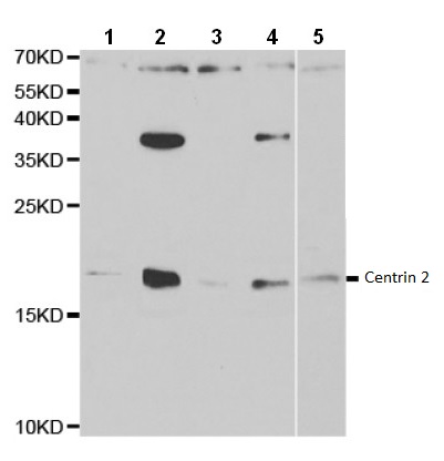 Western blot - Anti-Centrin 2 antibody (AB196554), expandable thumbnail