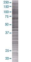 SDS-PAGE - Centrin 2 overexpression 293T lysate (whole cell) (AB94332)