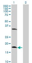 Western blot - Centrin 2 overexpression 293T lysate (whole cell) (AB94332)
