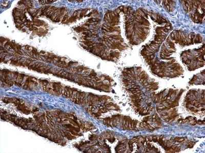 Immunohistochemistry (Formalin/PFA-fixed paraffin-embedded sections) - Anti-Centrin 3 antibody (AB228690)