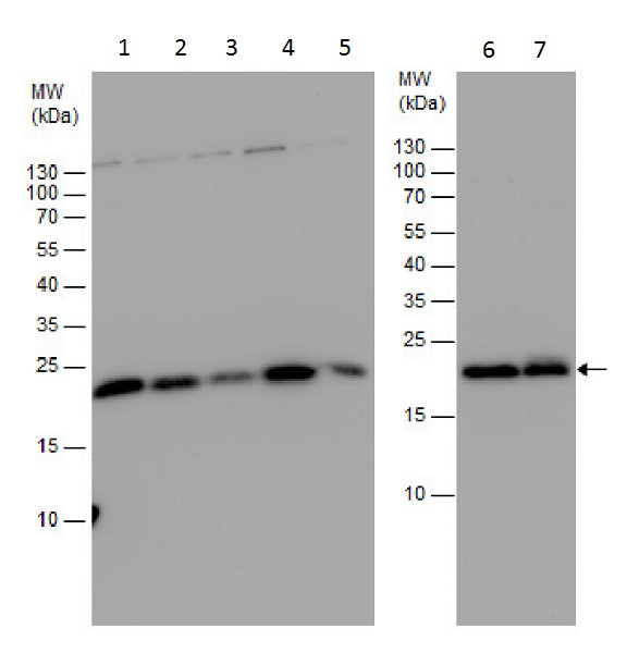 Western blot - Anti-Centrin 3 antibody (AB228690), expandable thumbnail