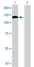 Western blot - Anti-Centrobin antibody (AB70448)