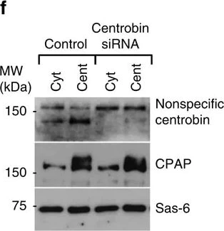 Western blot - Anti-Centrobin antibody (AB70448)