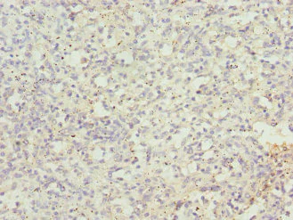 Immunohistochemistry (Formalin/PFA-fixed paraffin-embedded sections) - Anti-CEP120 antibody (AB230239)