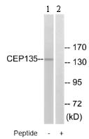 Western blot - Anti-CEP135 antibody (AB75005)