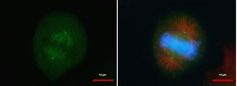 Immunocytochemistry/ Immunofluorescence - Anti-CEP152 antibody (AB183911), expandable thumbnail