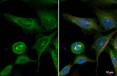 Anti-CEP170 antibody (ab84545) | Abcam