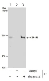 Immunoprecipitation - Anti-CEP152 antibody (AB183911)