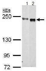 Western blot - Anti-CEP152 antibody (AB183911), expandable thumbnail