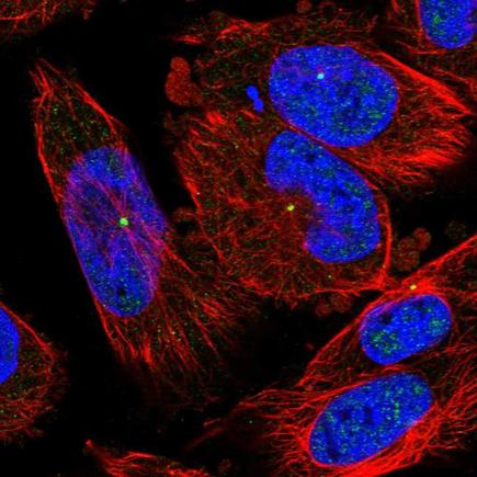 Immunocytochemistry/ Immunofluorescence - Anti-CEP164 antibody (AB221447)
