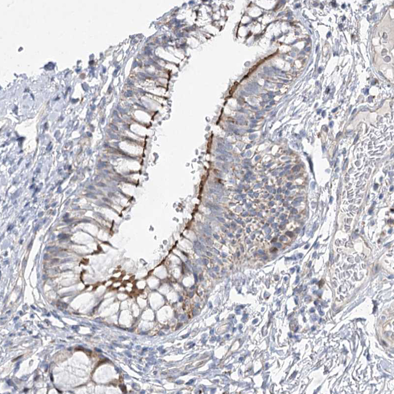 Immunohistochemistry (Formalin/PFA-fixed paraffin-embedded sections) - Anti-CEP164 antibody (AB221447)