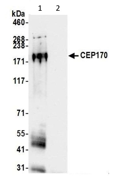 Immunoprecipitation - Anti-CEP170 antibody (AB72505), expandable thumbnail