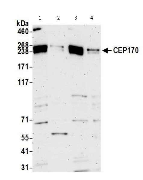 Western blot - Anti-CEP170 antibody (AB72505), expandable thumbnail