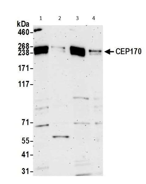 Western blot - Anti-CEP170 antibody (AB72505)
