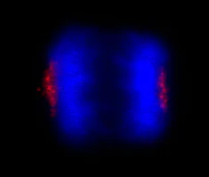 Immunocytochemistry/ Immunofluorescence - Anti-CEP170 antibody (AB84545)