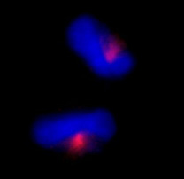 Immunocytochemistry/ Immunofluorescence - Anti-CEP170 antibody (AB84545)