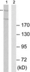 Western blot - Anti-CEP290 antibody (AB190237)