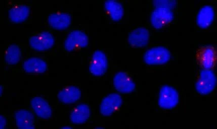 Immunocytochemistry/ Immunofluorescence - Anti-CEP290 antibody (AB84870)