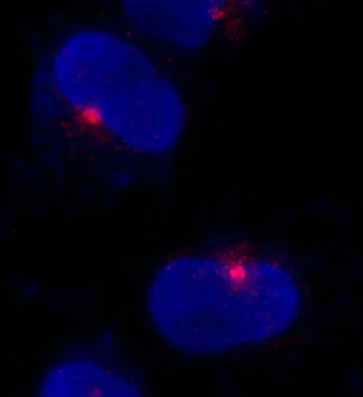 Immunocytochemistry - Anti-CEP290 antibody (AB85728)