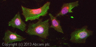 Immunocytochemistry - Anti-CEP290 antibody (AB85728)