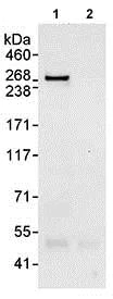 Immunoprecipitation - Anti-CEP290 antibody (AB85728)