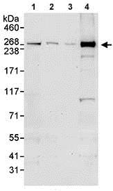 Western blot - Anti-CEP290 antibody (AB85728)