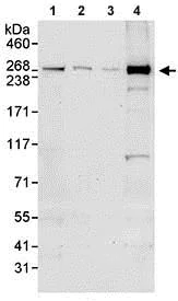 Western blot - Anti-CEP290 antibody (AB85728)