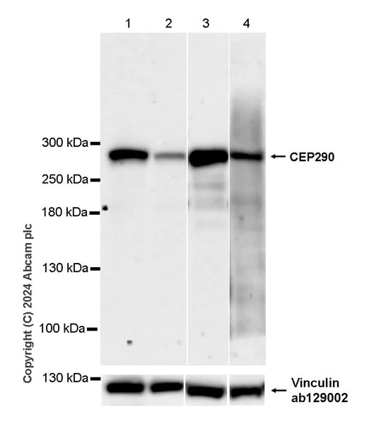 Western blot - Anti-CEP290 antibody [EPR28924-76] - BSA and Azide free (AB318279)
