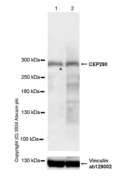 Western blot - Anti-CEP290 antibody [EPR28924-76] - BSA and Azide free (AB318279)