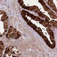 Immunohistochemistry (Formalin/PFA-fixed paraffin-embedded sections) - Anti-CEP295 antibody (AB122490)