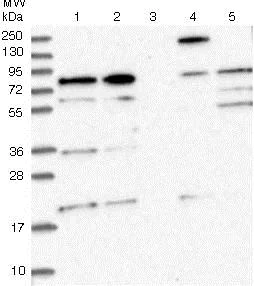 Western blot - Anti-CEP295 antibody (AB122490)