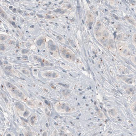 Immunohistochemistry (Formalin/PFA-fixed paraffin-embedded sections) - Anti-CEP350 antibody [CL3423] (AB219831)