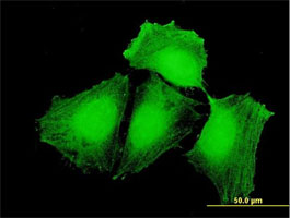 Immunocytochemistry/ Immunofluorescence - Anti-CEP57 antibody (AB169301)