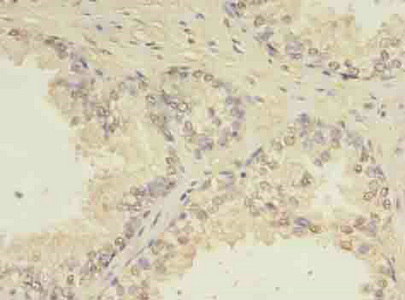 Immunohistochemistry (Formalin/PFA-fixed paraffin-embedded sections) - Anti-CEP63 antibody (AB235513), expandable thumbnail