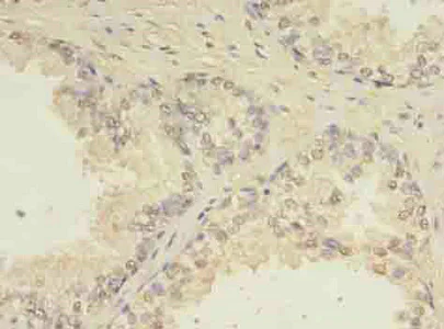 Immunohistochemistry (Formalin/PFA-fixed paraffin-embedded sections) - Anti-CEP63 antibody (AB235513)