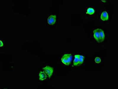 Immunocytochemistry/ Immunofluorescence - Anti-CEP70 antibody (AB237801)