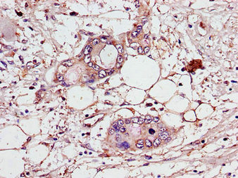 Immunohistochemistry (Formalin/PFA-fixed paraffin-embedded sections) - Anti-CEP70 antibody (AB237801)