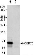Immunoprecipitation - Anti-CEP76 antibody (AB86613)