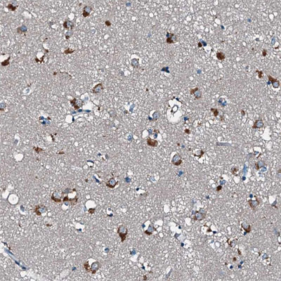 Immunohistochemistry (Formalin/PFA-fixed paraffin-embedded sections) - Anti-CEP89 antibody (AB204410)