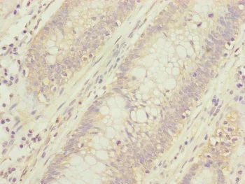 Immunohistochemistry (Formalin/PFA-fixed paraffin-embedded sections) - Anti-CEP95 antibody (AB230305)