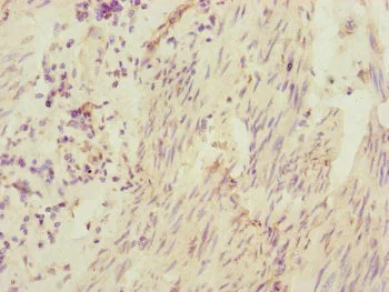 Immunohistochemistry (Formalin/PFA-fixed paraffin-embedded sections) - Anti-CEP95 antibody (AB230305)
