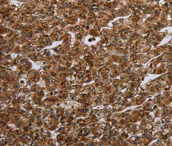 Immunohistochemistry (Formalin/PFA-fixed paraffin-embedded sections) - Anti-Ceramide synthase 1/LAG1 antibody (AB198799)