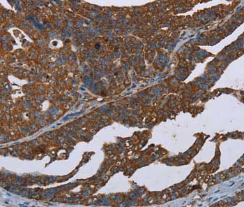 Immunohistochemistry (Formalin/PFA-fixed paraffin-embedded sections) - Anti-Ceramide synthase 1/LAG1 antibody (AB198799)