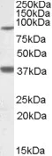 Western blot - Anti-Ceramide synthase 1/LAG1 antibody (AB85696)
